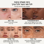 RN7 - Tan Dark Rosy Neutral